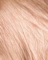 Huidindactie Huidveroudering - Beautique Salon - huidverbetering - huidverbeterende behandelingen